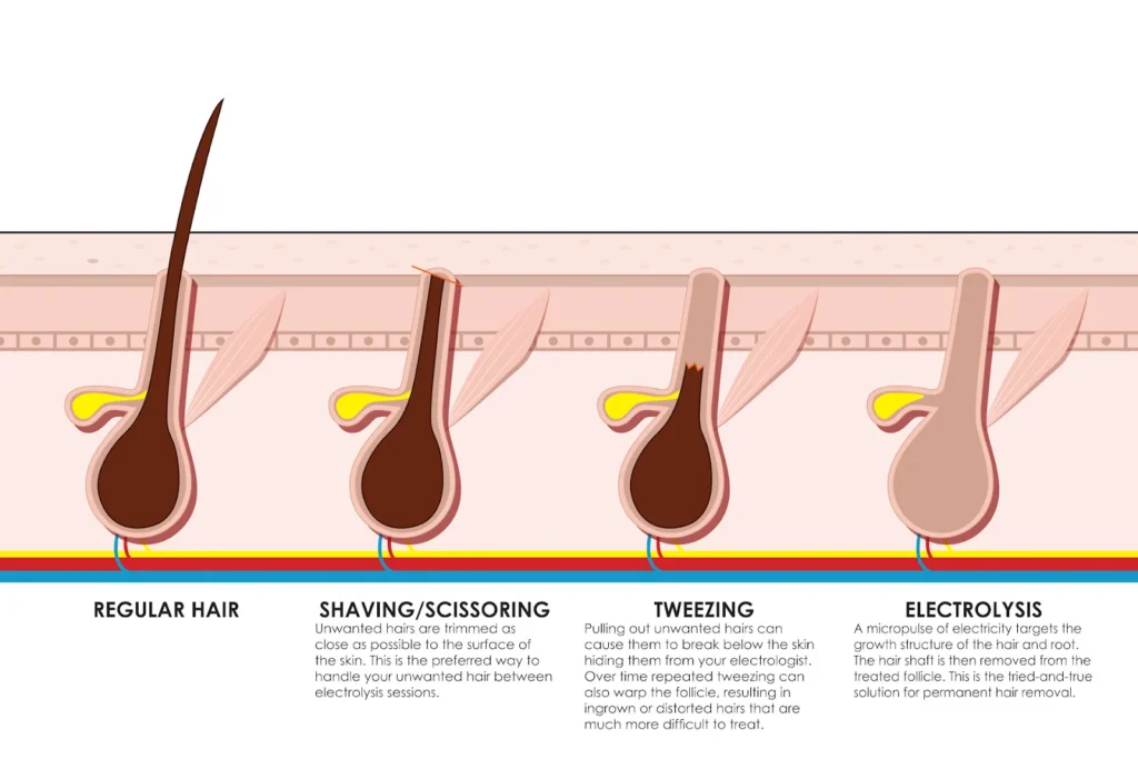 Electrolysis